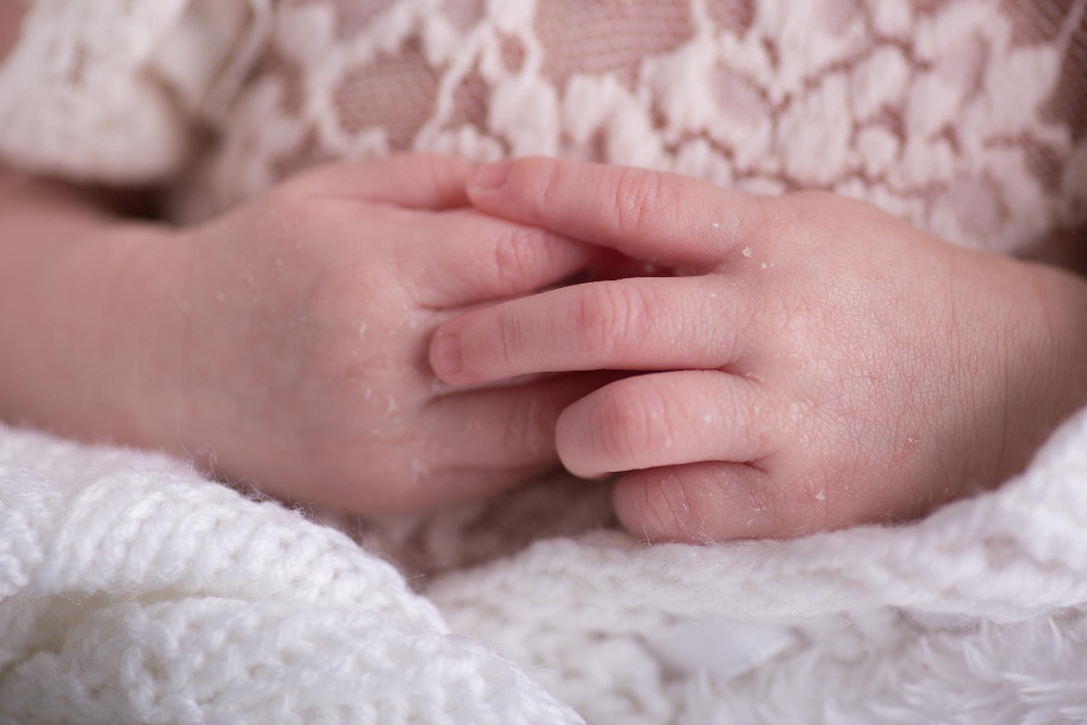 Tanda Kulit Bayi Sensitif, Moms Harus Tahu Gejalanya!