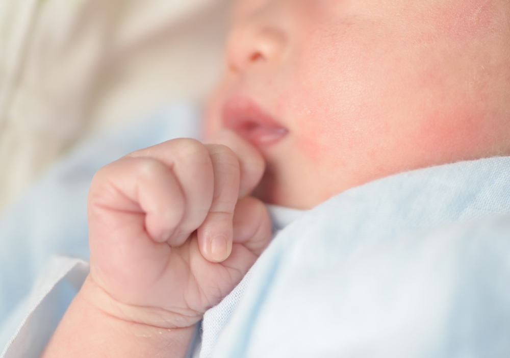 Perawatan Kulit Bayi di Musim Pancaroba